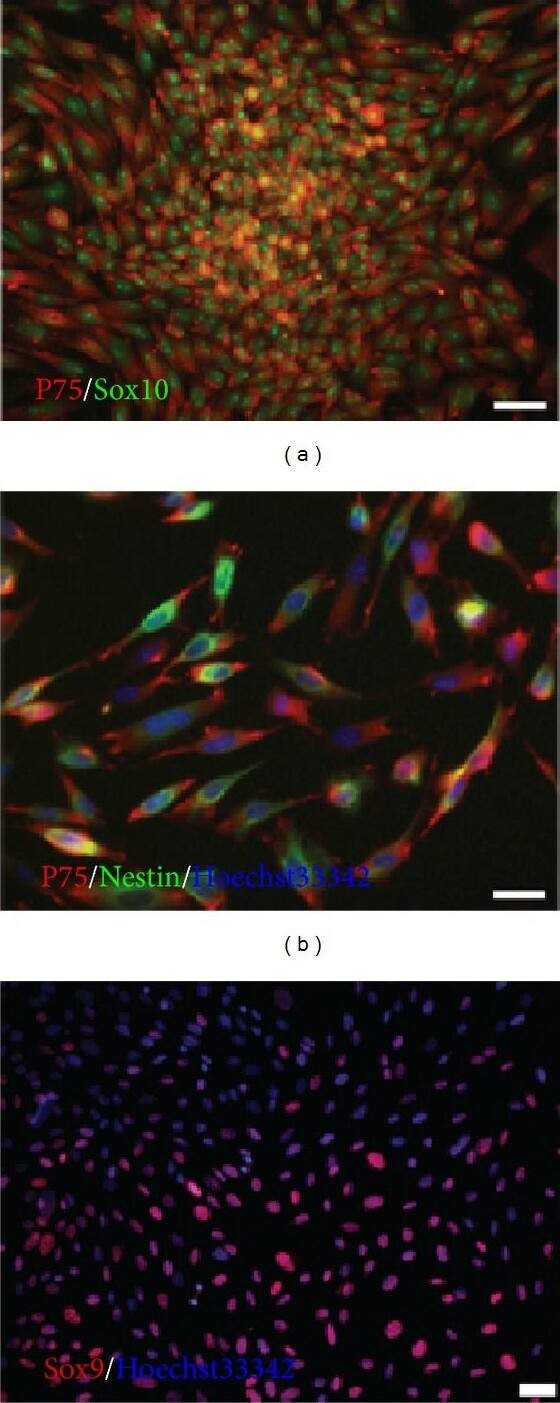 Detection of Rat SOX10 by Immunocytochemistry/Immunofluorescence