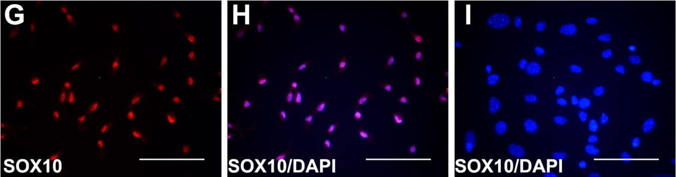 Detection of Mouse SOX10 by Immunocytochemistry/Immunofluorescence