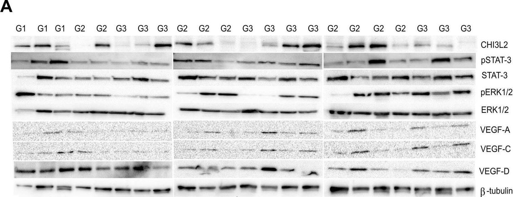 Detection of VEGF-D by Western Blot