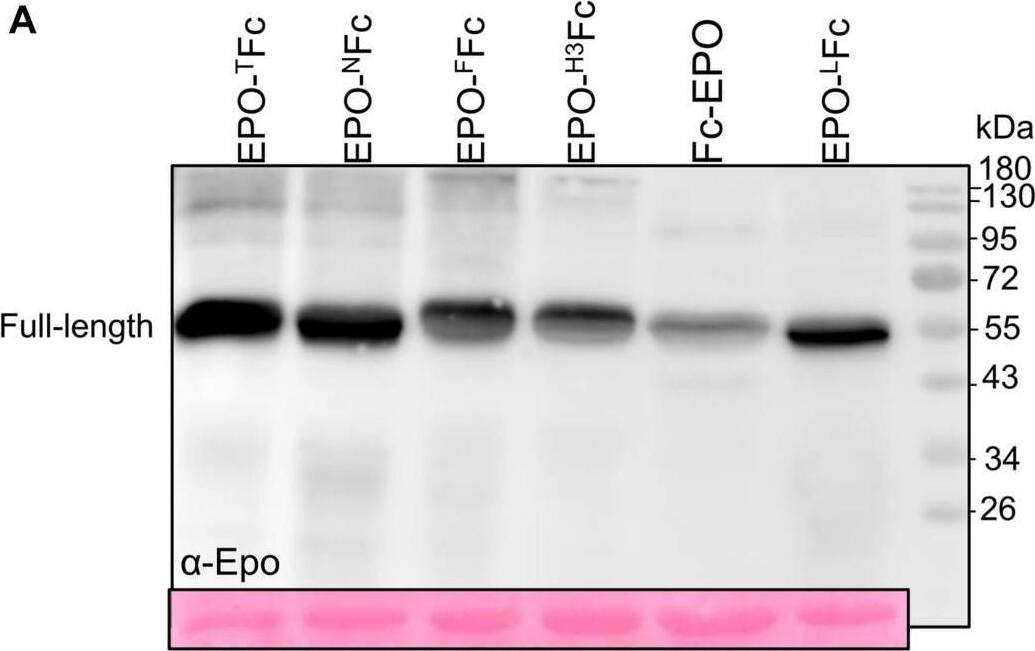 Detection of Erythropoietin/EPO by Western Blot