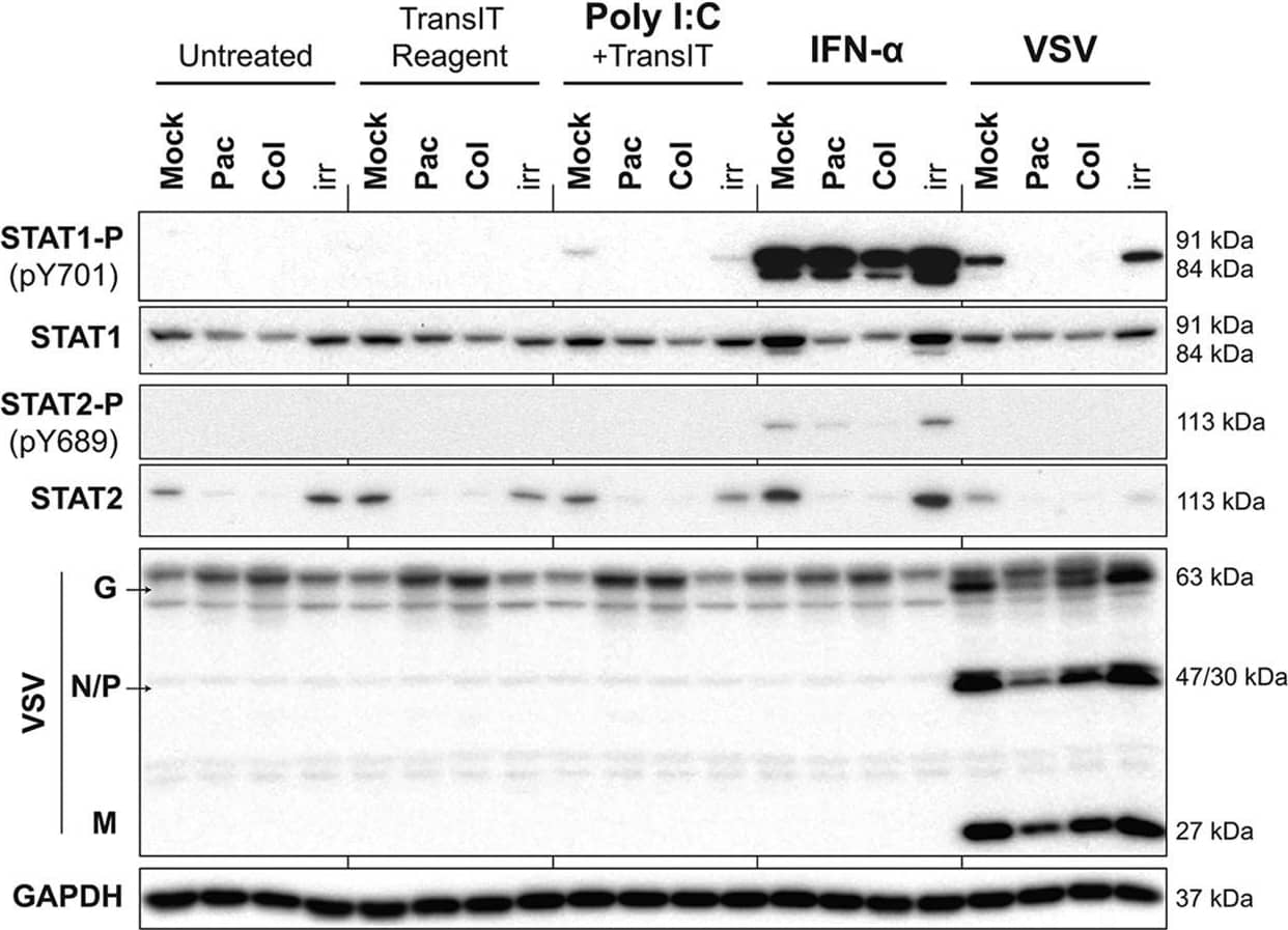 Detection of Human STAT2 by Western Blot