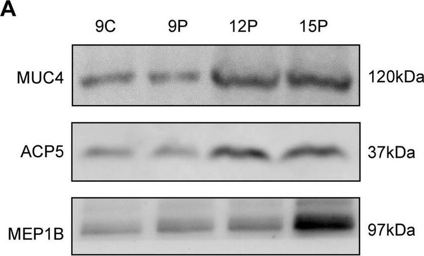 Detection of Meprin  beta Subunit/MEP1B by Western Blot