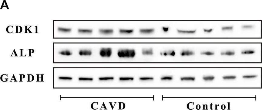 Detection of Alkaline Phosphatase/ALPL by Western Blot