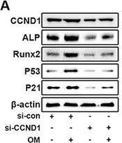 Detection of Alkaline Phosphatase/ALPL by Western Blot