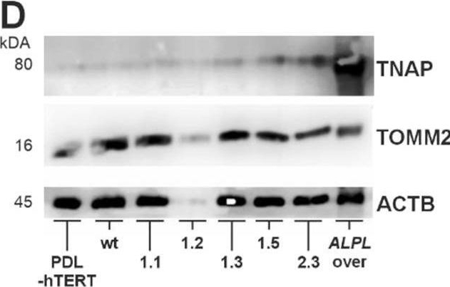 Detection of Alkaline Phosphatase/ALPL by Western Blot