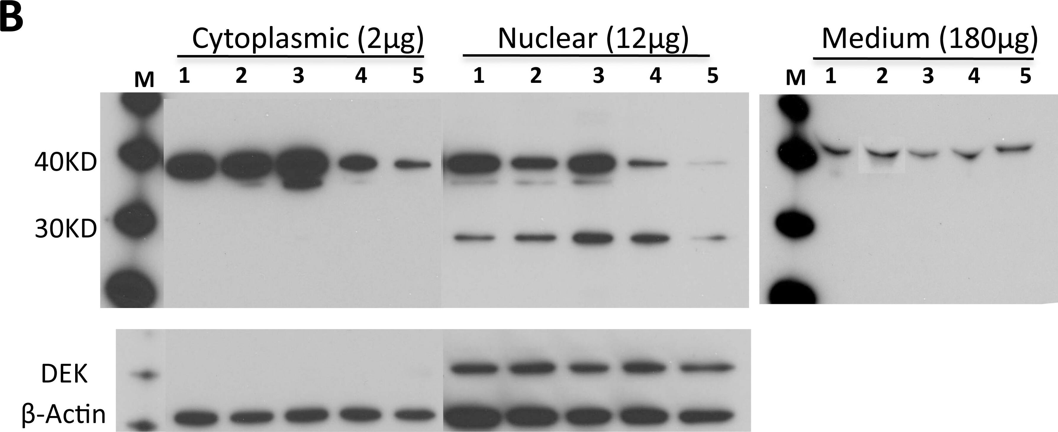Detection of Human HTRA1/PRSS11 by Western Blot