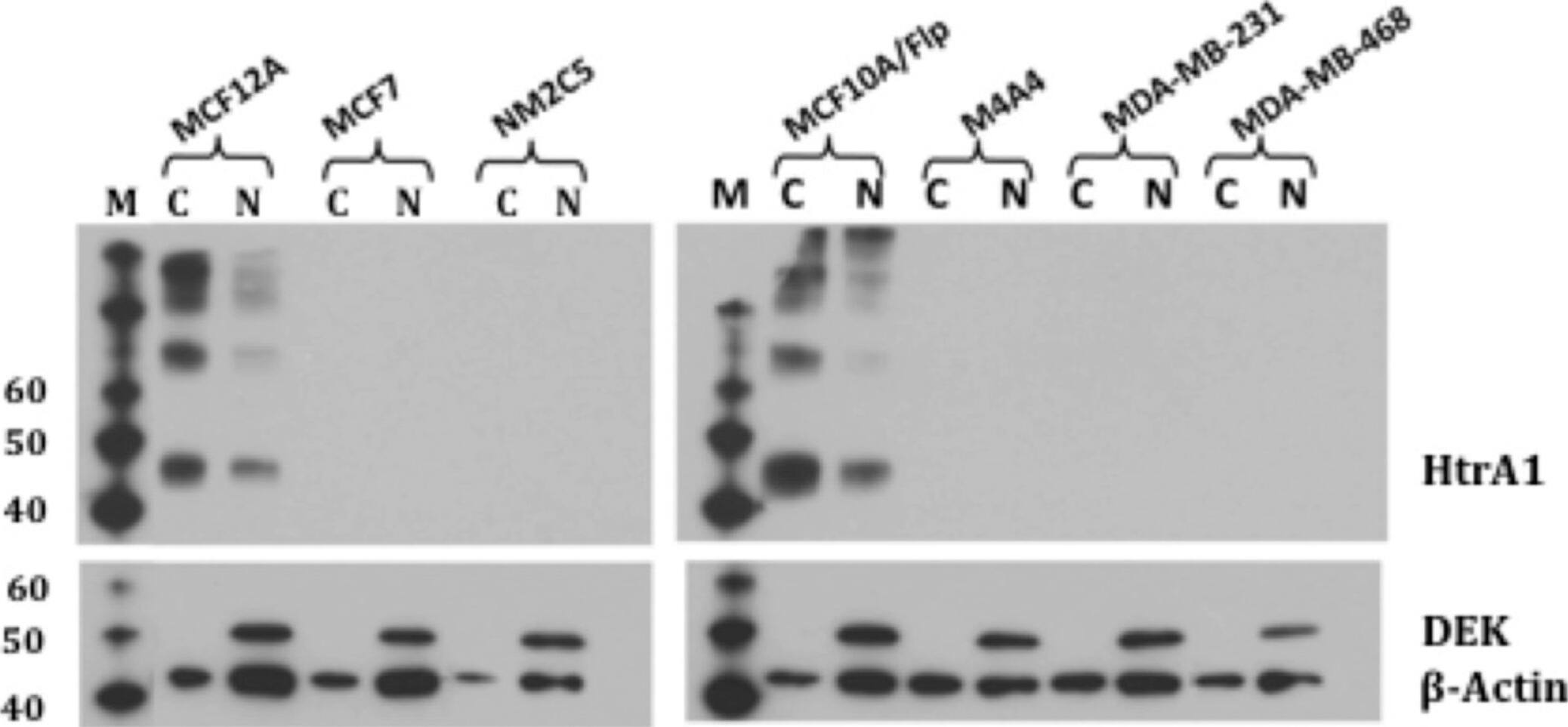 Detection of Human HTRA1/PRSS11 by Western Blot