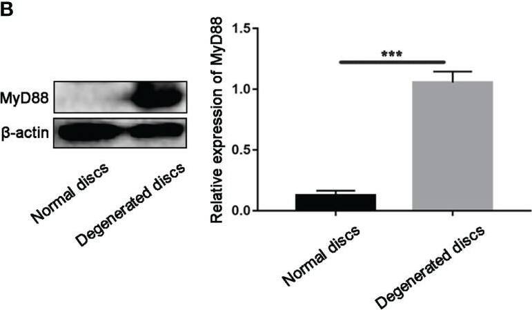 Detection of MyD88 by Western Blot