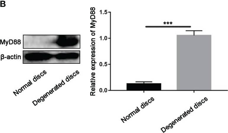 Detection of MyD88 by Western Blot