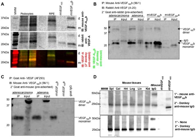 Human VEGF165b Antibody VEGF expression determined by Western blot