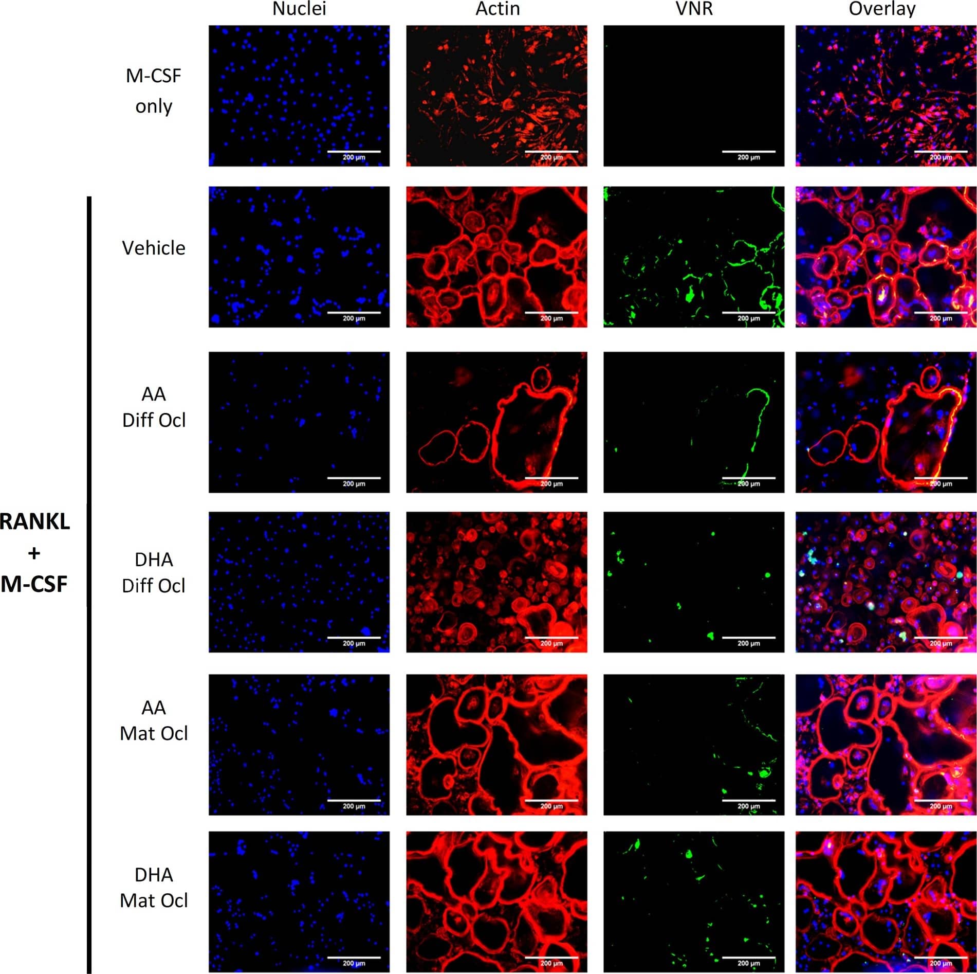 Detection of Human Integrin alpha V beta 3 by Immunocytochemistry/Immunofluorescence