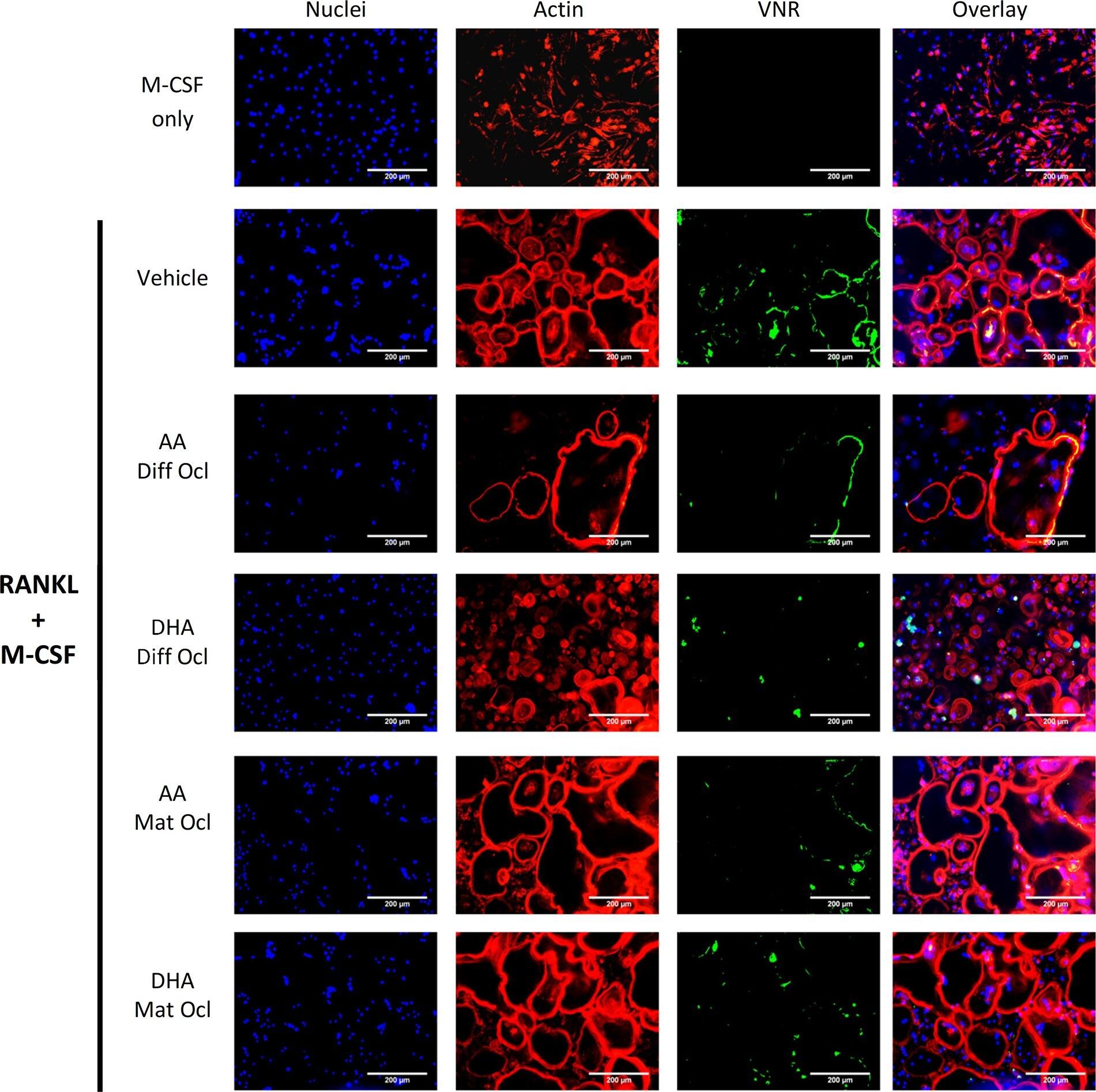 Detection of Human Integrin alpha V beta 3 by Immunocytochemistry/ Immunofluorescence