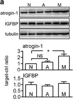 Detection of Mouse Human IGFBP-3 Antibody by Western Blot