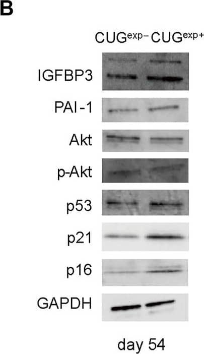 Detection of Human IGFBP-3 by Western Blot
