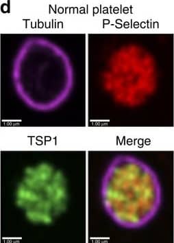 Detection of Human Thrombospondin-1 by Immunocytochemistry/Immunofluorescence