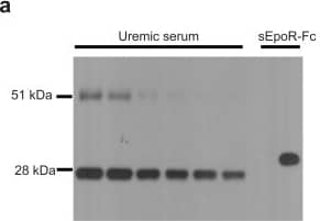 Detection of Human Erythropoietin R by Western Blot