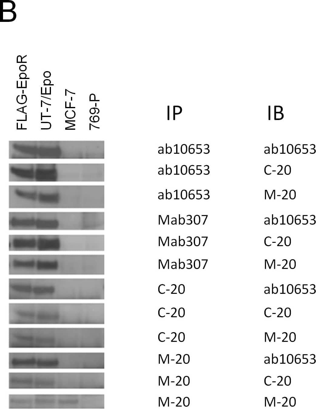 Detection of Mouse Erythropoietin R by Western Blot