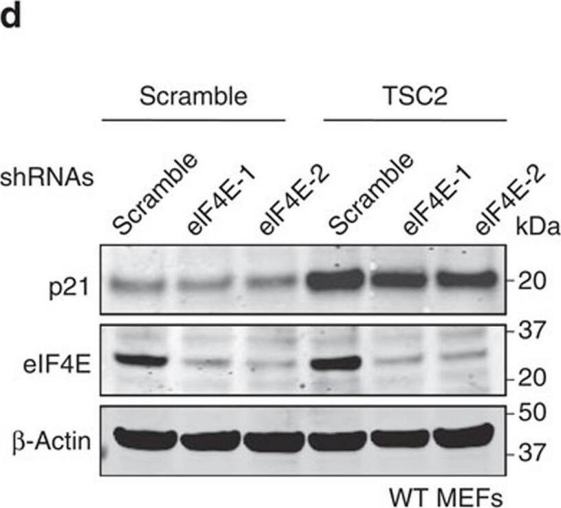 Detection of eIF4E by Western Blot