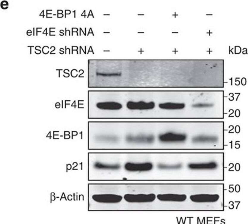 Detection of eIF4E by Western Blot
