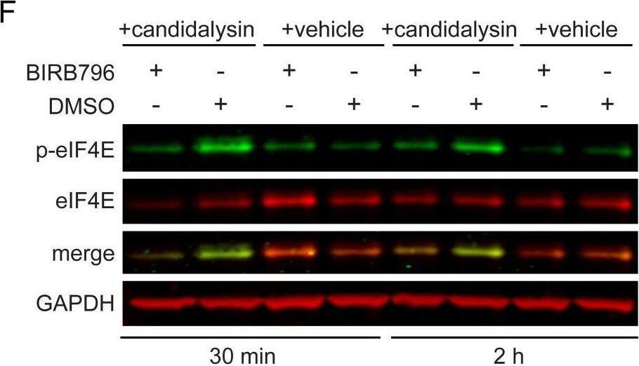 Detection of eIF4E by Western Blot