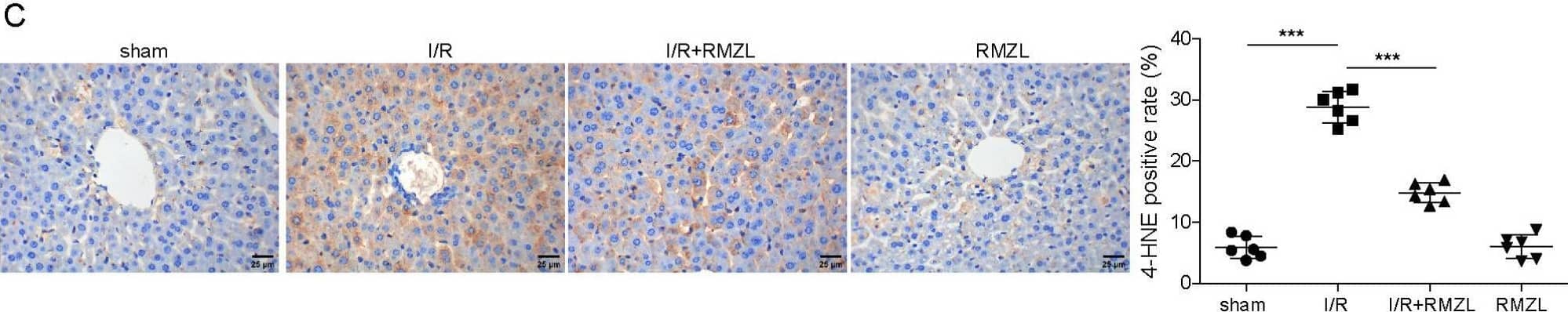 Detection of Mouse 4-Hydroxynonenal by Immunohistochemistry