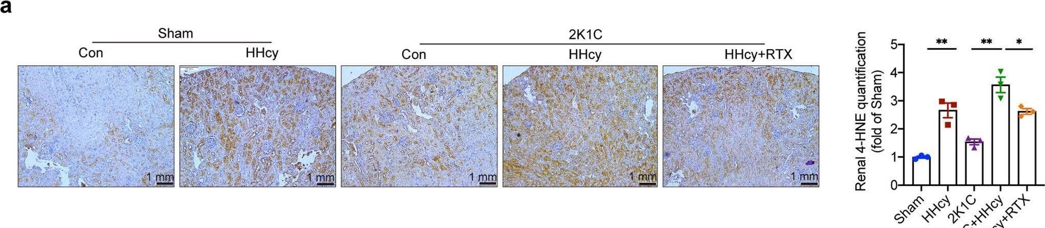 Detection of 4-Hydroxynonenal by Immunohistochemistry