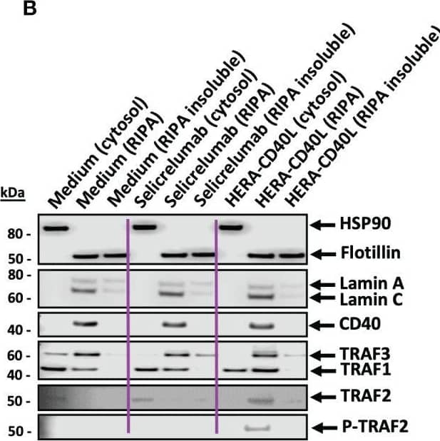 Detection of TRAF-2 by Western Blot
