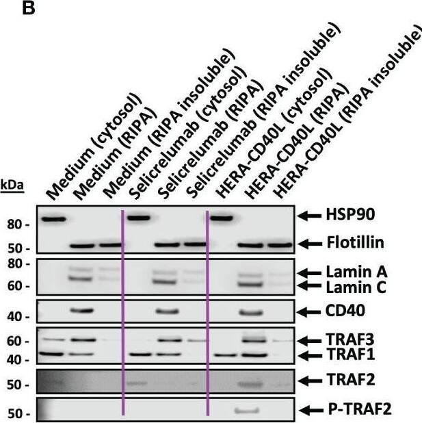 Detection of TRAF-2 by Western Blot