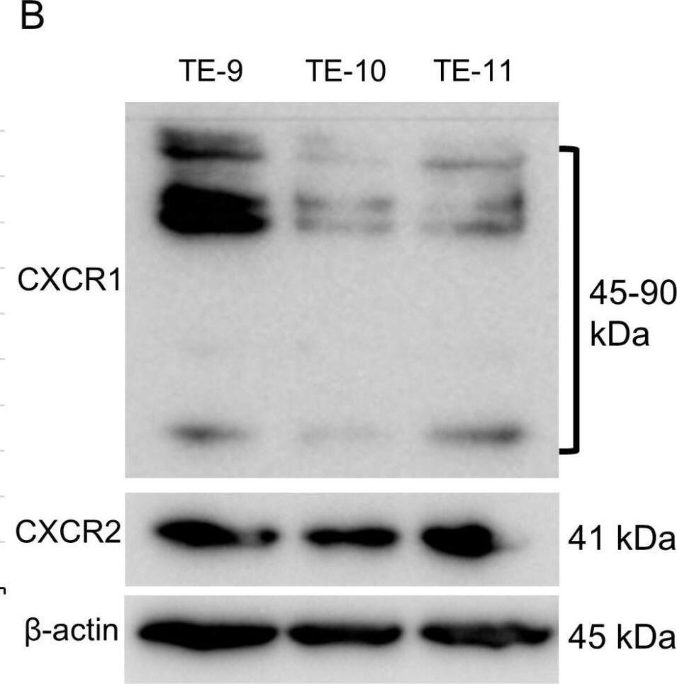 Detection of CXCR1/IL-8RA by Western Blot