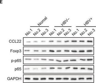 Detection of Human CCL22/MDC by Western Blot