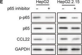 Detection of Human CCL22/MDC by Western Blot