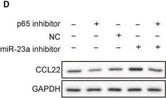 Detection of Human CCL22/MDC by Western Blot