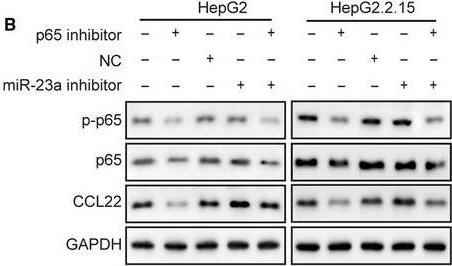 Detection of Human CCL22/MDC by Western Blot