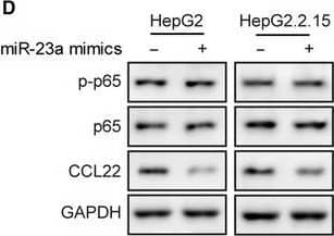 Detection of Human CCL22/MDC by Western Blot