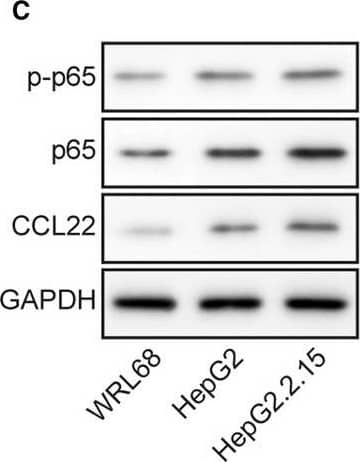 Detection of Human CCL22/MDC by Western Blot