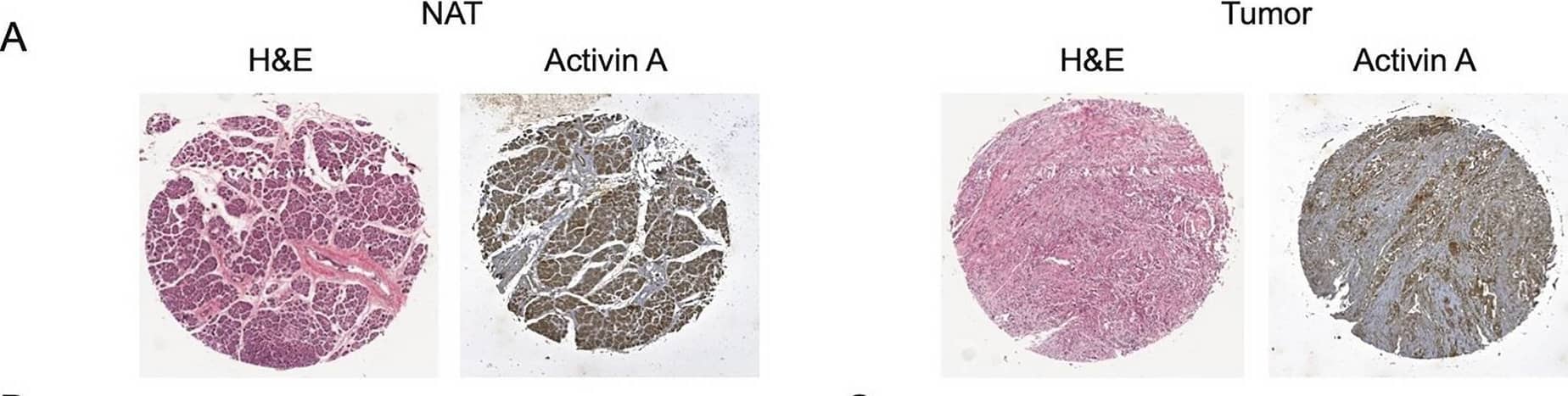 Detection of Activin A  betaA subunit by Immunohistochemistry