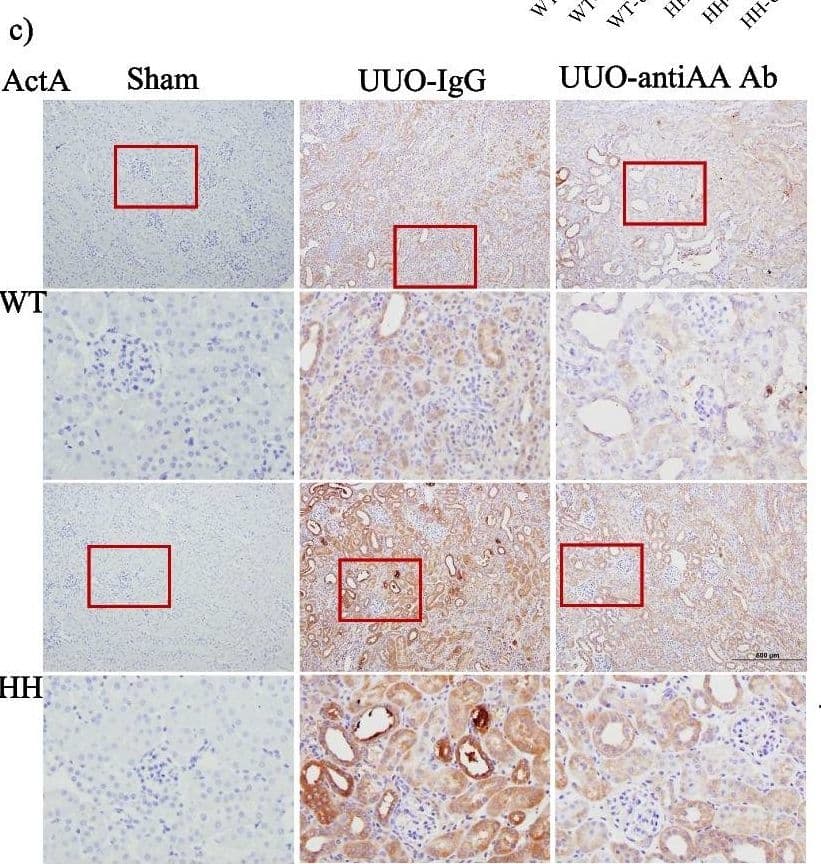 Detection of Activin A  betaA subunit by Immunohistochemistry
