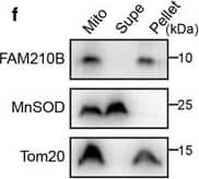 Detection of Human SOD2/Mn-SOD by Western Blot