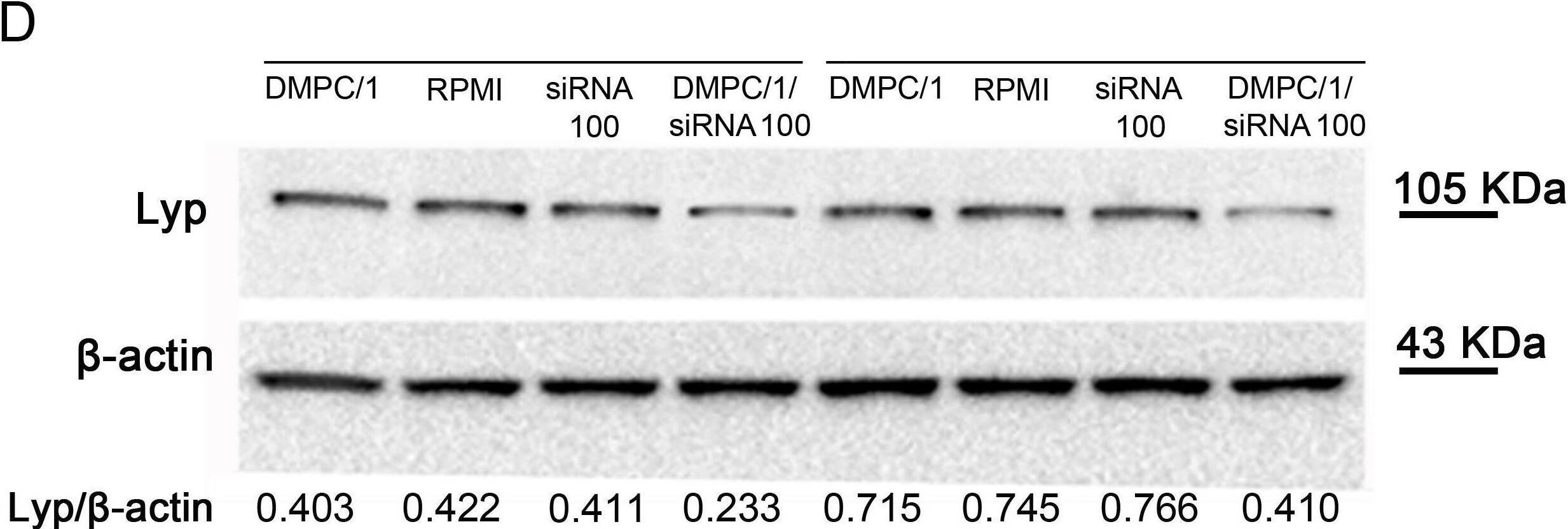 Detection of Lyp by Western Blot