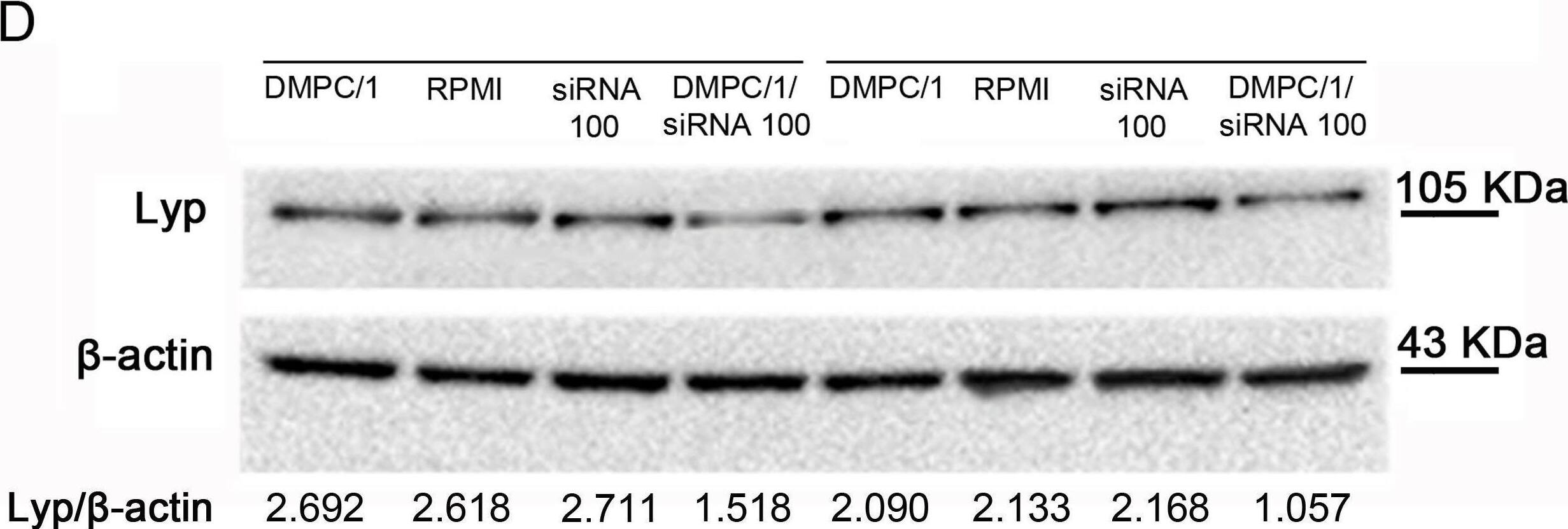 Detection of Lyp by Western Blot