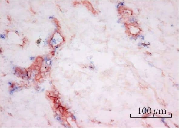 Detection of Human Endothelin-1 by Immunohistochemistry