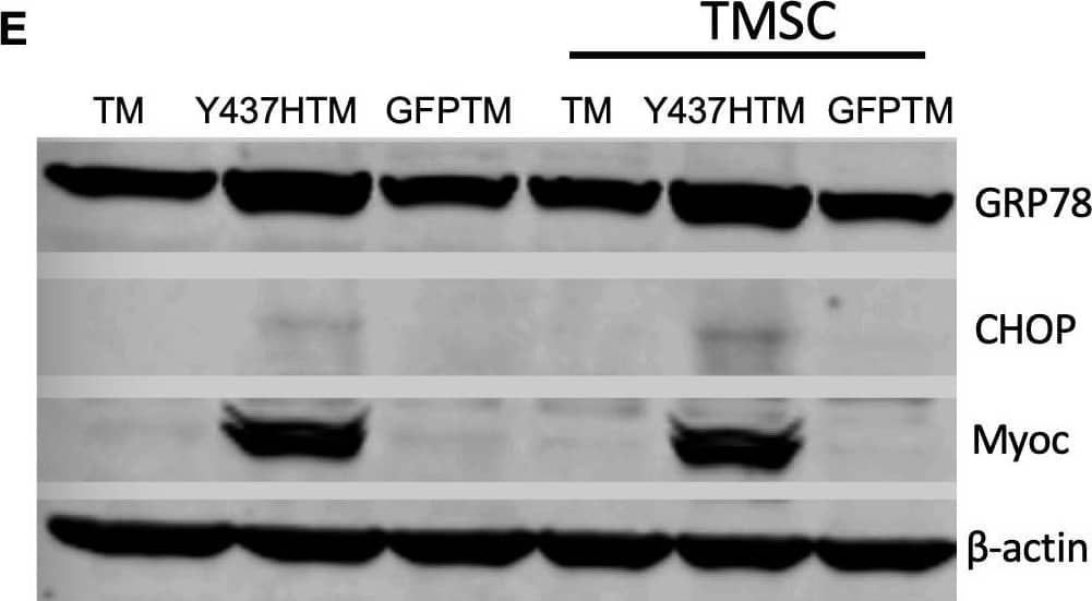 Detection of Mouse Myocilin by Western Blot