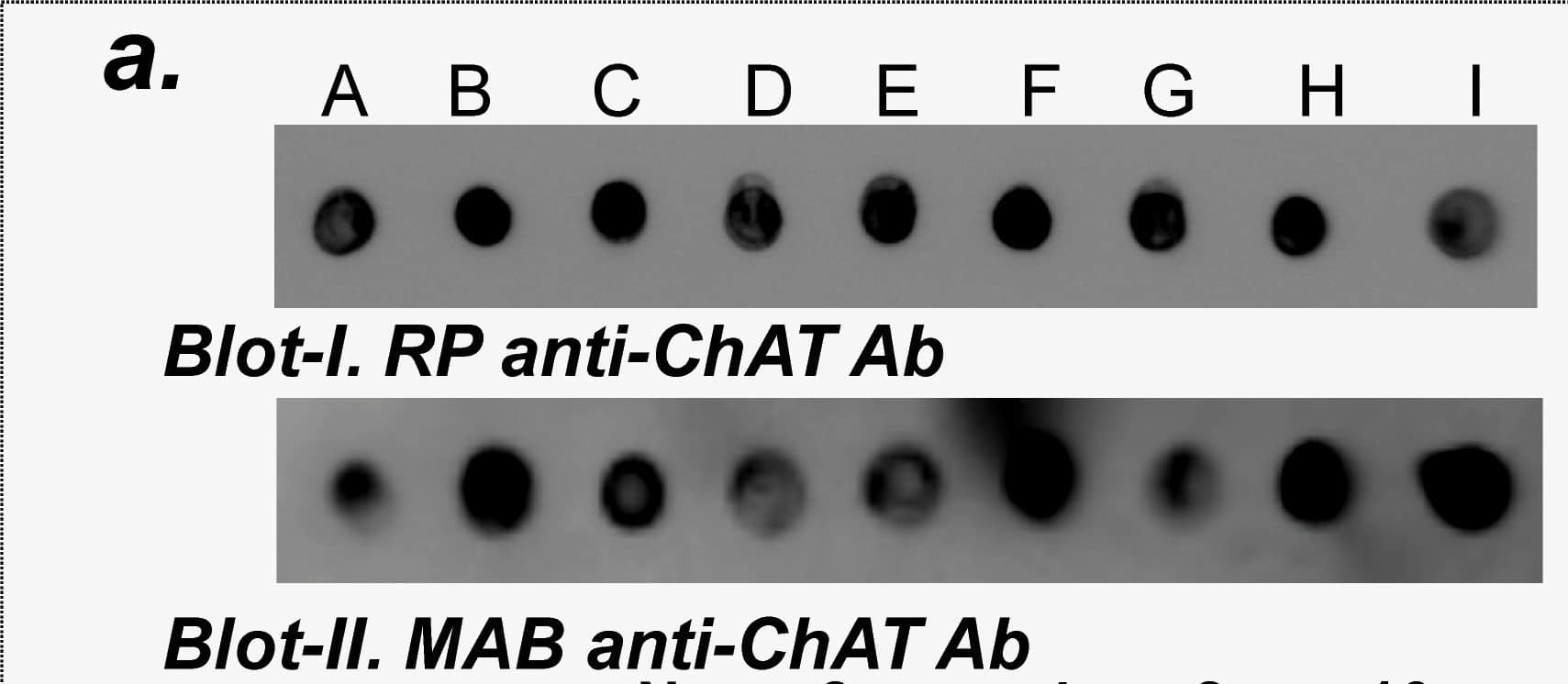 Detection of Human Choline Acetyltransferase/ChAT by Dot Blot