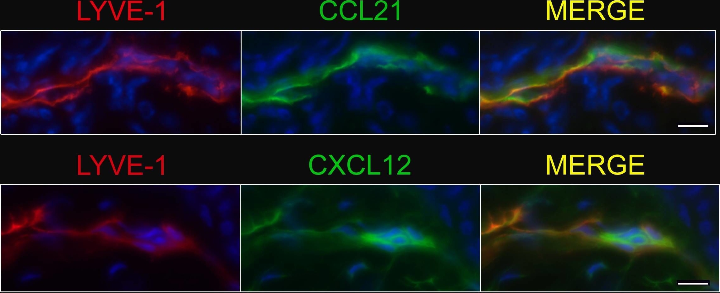 Detection of Mouse CXCL12/SDF-1 by Immunohistochemistry