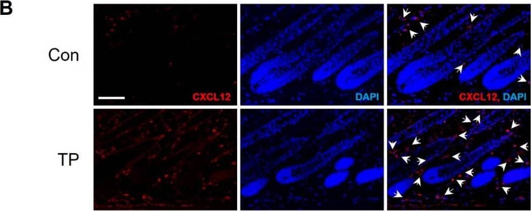 Detection of CXCL12/SDF-1 by Immunohistochemistry