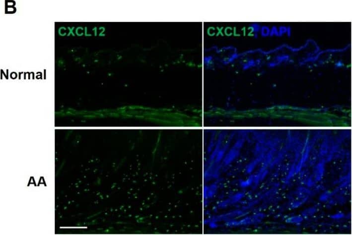 Detection of CXCL12/SDF-1 by Immunohistochemistry