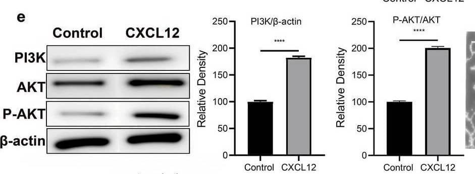 Detection of CXCL12/SDF-1 by Western Blot