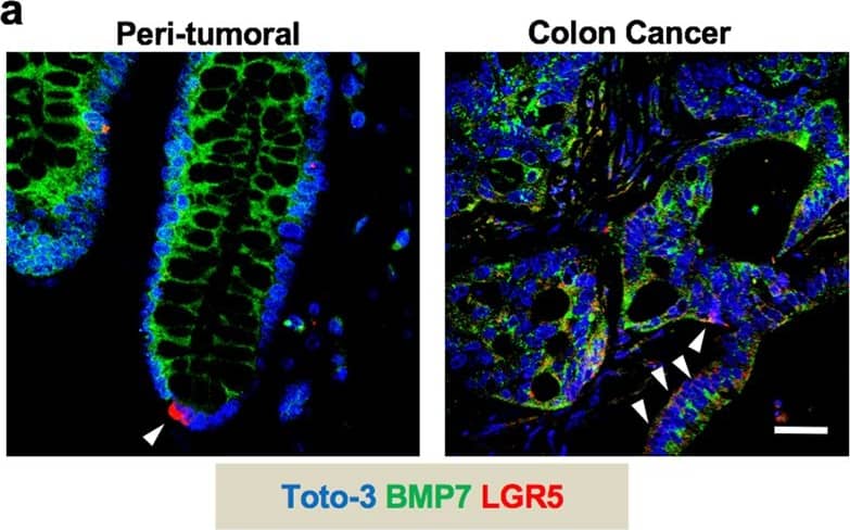Detection of Human BMP-7 by Immunocytochemistry/Immunofluorescence