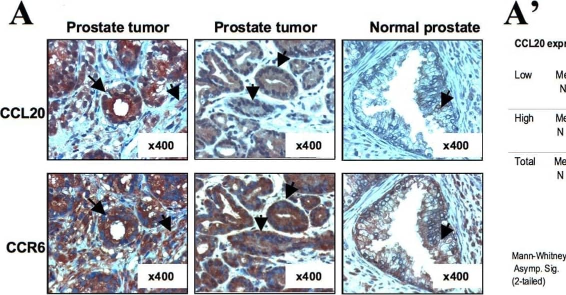 Detection of CCL20/MIP-3 alpha by Immunohistochemistry
