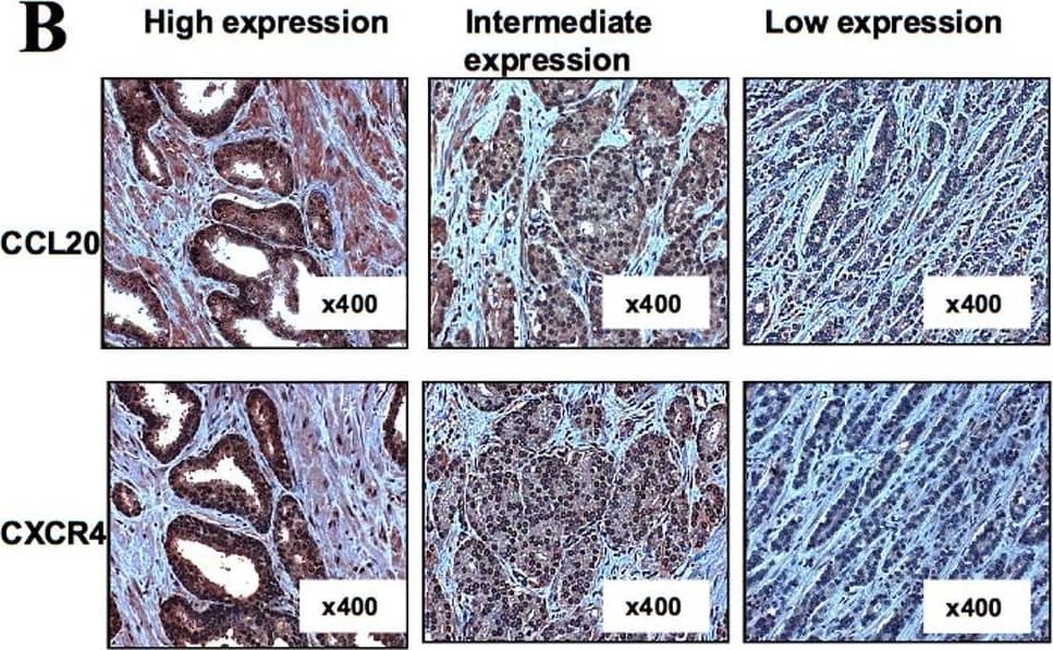 Detection of CCL20/MIP-3 alpha by Immunohistochemistry